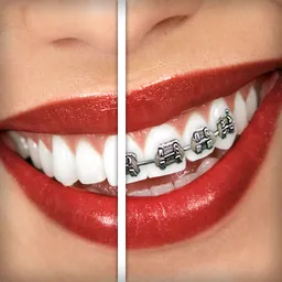 Brace Face logo