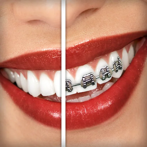 Brace Face logo