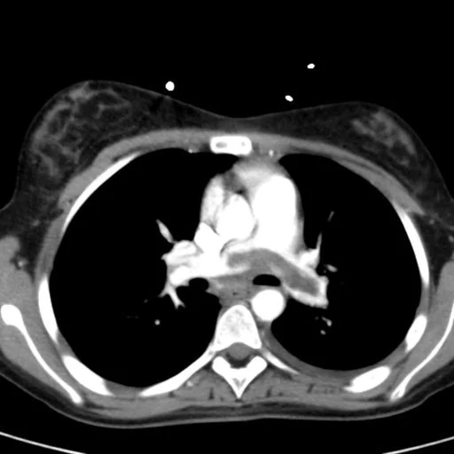 Crit-IQ CT Interpretation logo